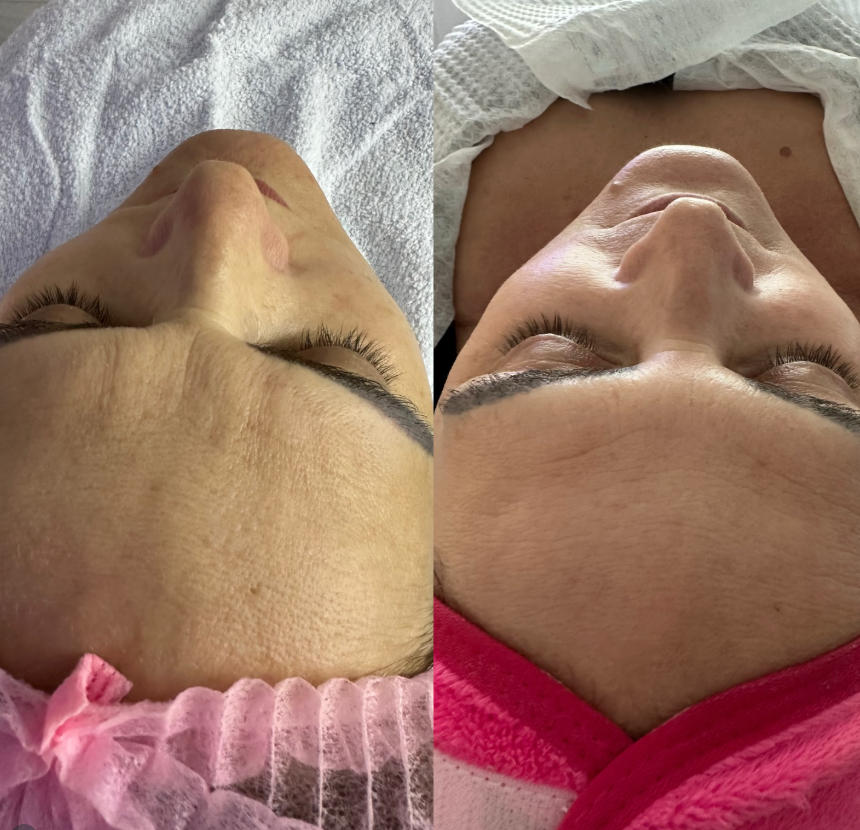 Resultado real antes e depois